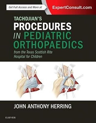 Tachdjian's Procedures in Pediatric Orthopaedics: From the Texas Scottish Rite Hospital for Children 2016