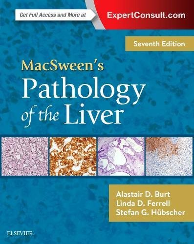 MacSween's Pathology of the Liver 2017