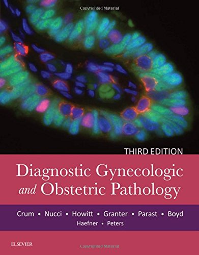 Diagnostic Gynecologic and Obstetric Pathology 2017