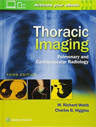 Thoracic Imaging: Pulmonary and Cardiovascular Radiology 2016