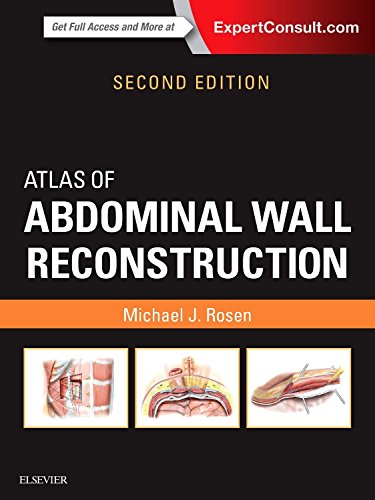 Atlas of Abdominal Wall Reconstruction 2016