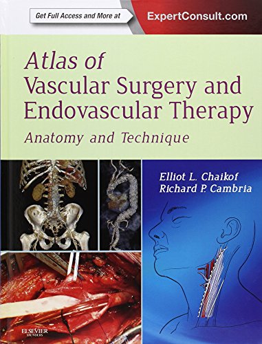 Atlas of Vascular Surgery and Endovascular Therapy: Anatomy and Technique 2014