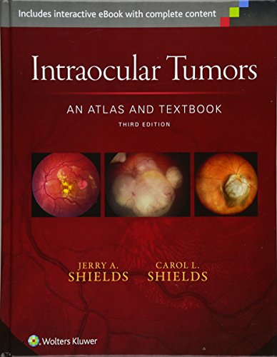 Intraocular Tumors: An Atlas and Textbook 2015