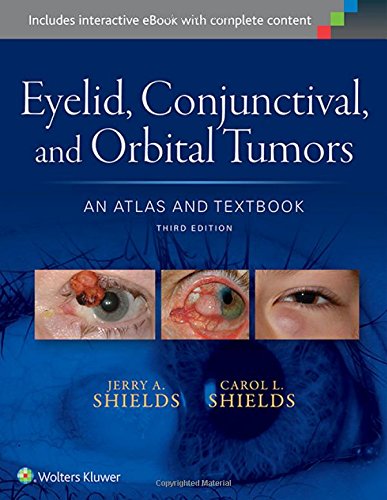 Eyelid, Conjunctival, and Orbital Tumors: An Atlas and Textbook 2015