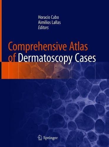 Comprehensive Atlas of Dermatoscopy Cases 2018
