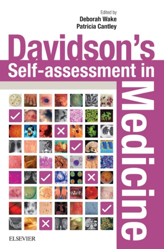 Davidson's Self-assessment in Medicine E-Book 2018