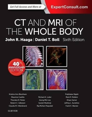 CT and MRI of the Whole Body 2016