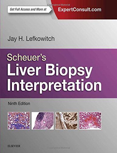 Scheuer's Liver Biopsy Interpretation 2015