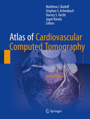 Atlas of Cardiovascular Computed Tomography 2018