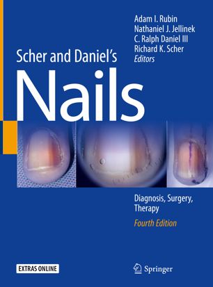 Scher and Daniel's Nails: Diagnosis, Surgery, Therapy 2018