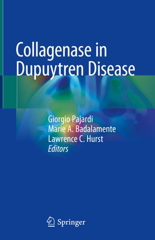 Collagenase in Dupuytren Disease 2018