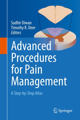 Advanced Procedures for Pain Management: A Step-by-Step Atlas 2018