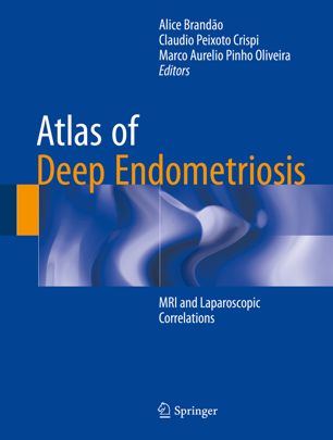 Atlas of Deep Endometriosis: MRI and Laparoscopic Correlations 2018