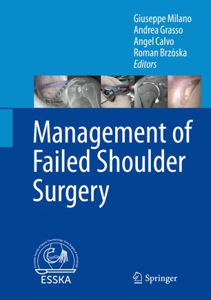 Management of Failed Shoulder Surgery 2018