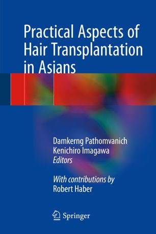 جنبه های عملی کاشت مو در آسیایی ها