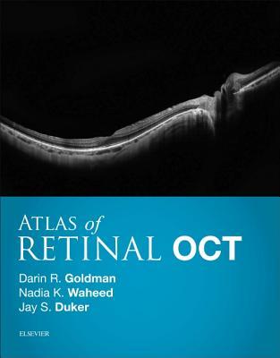Atlas of Retinal OCT E-Book: Optical Coherence Tomography 2017