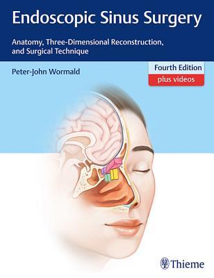 Endoscopic Sinus Surgery: Anatomy, Three-Dimensional Reconstruction, and Surgical Technique 2017