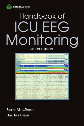 Handbook of ICU EEG Monitoring 2018