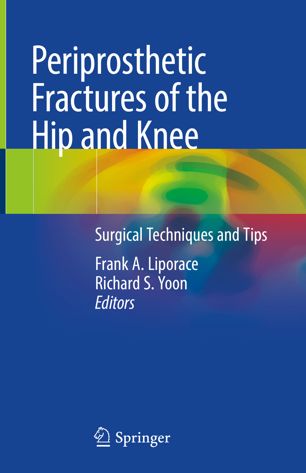 Periprosthetic Fractures of the Hip and Knee: Surgical Techniques and Tips 2018