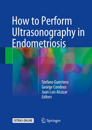 How to Perform Ultrasonography in Endometriosis 2018