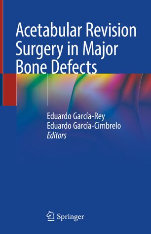 Acetabular Revision Surgery in Major Bone Defects 2018
