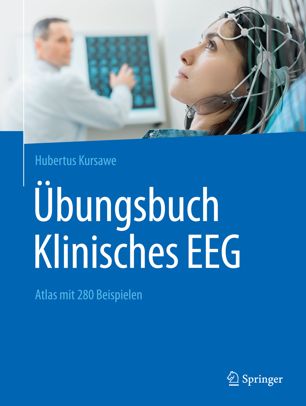 کتاب کار EEG بالینی: اطلس با 280 مثال