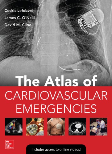 Atlas of Cardiovascular Emergencies 2015