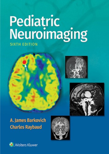 Pediatric Neuroimaging 2018