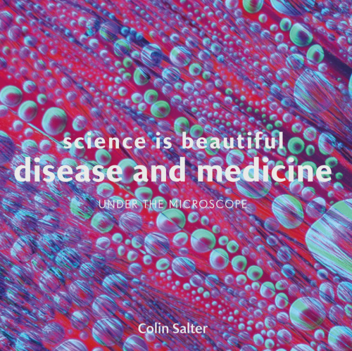 Science is Beautiful: Disease and Medicine: Under the Microscope 2017