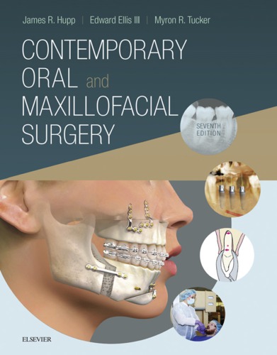 Contemporary Oral and Maxillofacial Surgery E-Book 2018