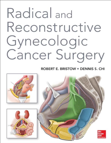 Radical and Reconstructive Gynecologic Cancer Surgery 2014