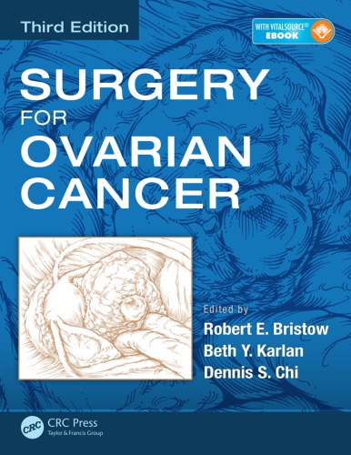 Surgery for Ovarian Cancer 2015