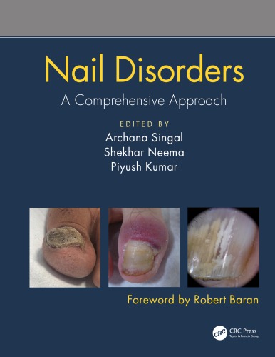 Nail Disorders: A Comprehensive Approach 2019