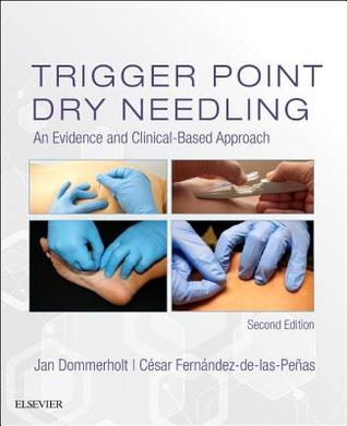 Trigger Point Dry Needling: An Evidence and Clinical-Based Approach 2018