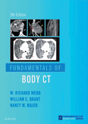 Fundamentals of Body CT 2006