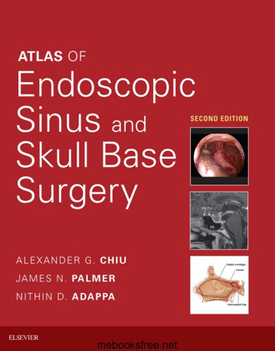 Atlas of Endoscopic Sinus and Skull Base Surgery E-Book 2018
