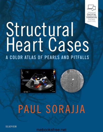 Structural Heart Cases: A Color Atlas of Pearls and Pitfalls 2018