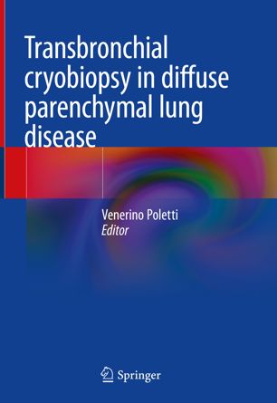 Transbronchial cryobiopsy in diffuse parenchymal lung disease 2019