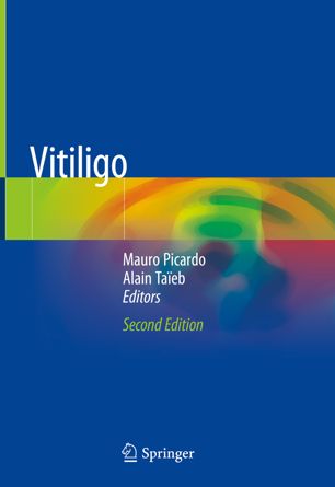 Vitiligo 2019