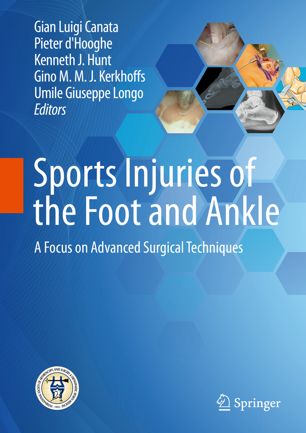 Sports Injuries of the Foot and Ankle: A Focus on Advanced Surgical Techniques 2019