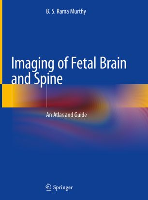 Imaging of Fetal Brain and Spine: An Atlas and Guide 2019