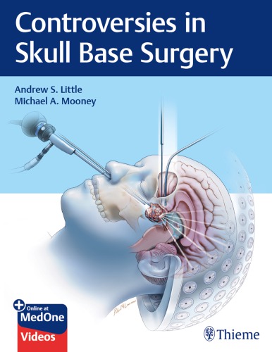 Controversies in Skull Base Surgery 2019