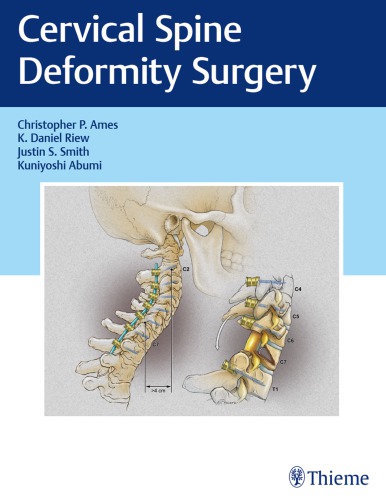 Cervical Spine Deformity Surgery 2019