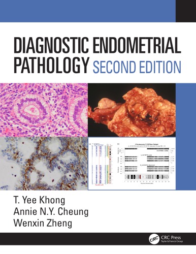 Diagnostic Endometrial Pathology 2E 2019