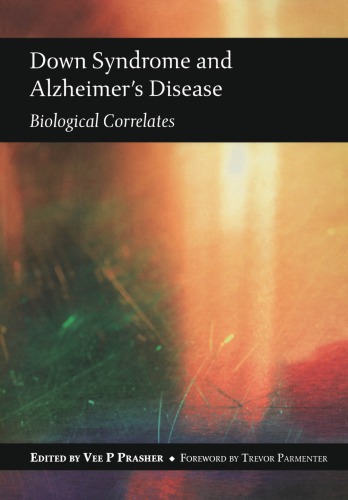 Down Syndrome and Alzheimer's Disease 2018