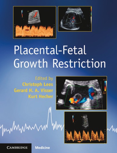 Placental-Fetal Growth Restriction 2018