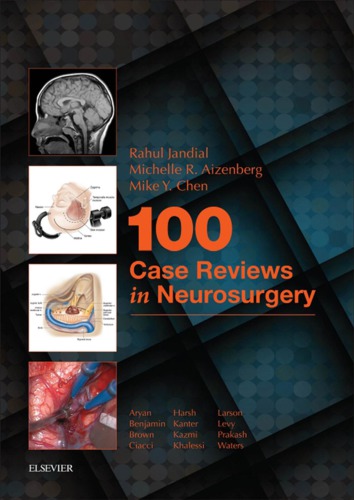 100 Case Reviews in Neurosurgery E-Book 2016