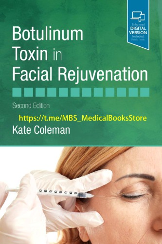 Botulinum Toxin in Facial Rejuvenation E-Book 2019