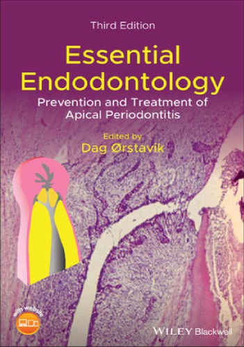 Essential Endodontology: Prevention and Treatment of Apical Periodontitis 2019