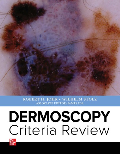 Dermoscopy Criteria Review 2019